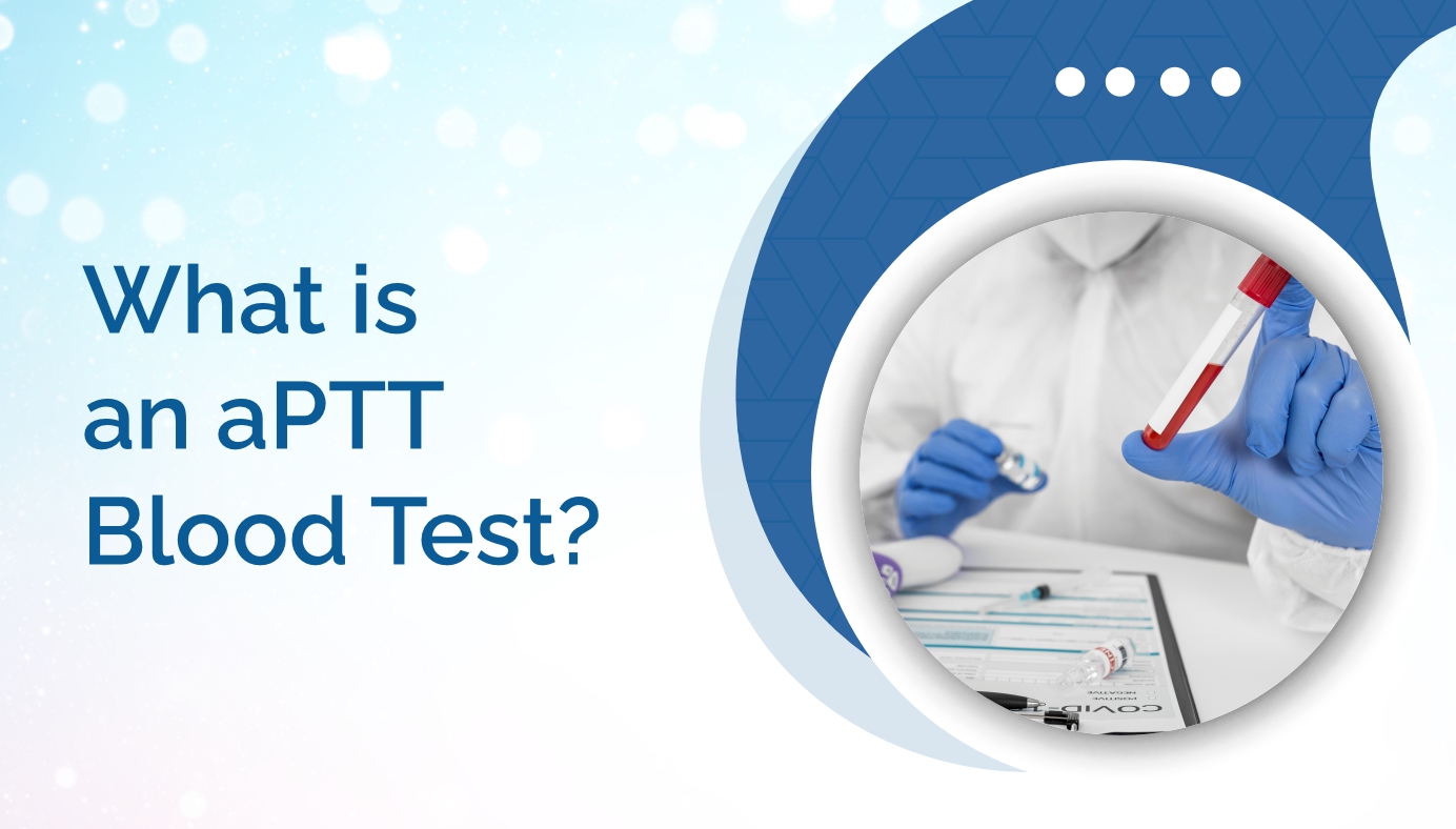 What Is an aPTT Blood Test?